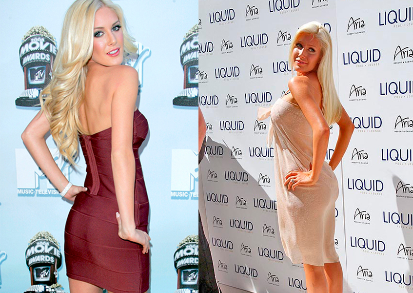  Хайди Монтаг