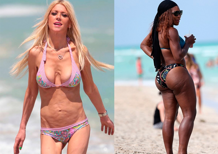 Самые пугающие фото звезд в бикини