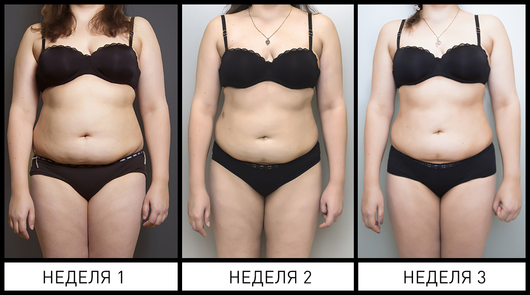 битва с лишним весом