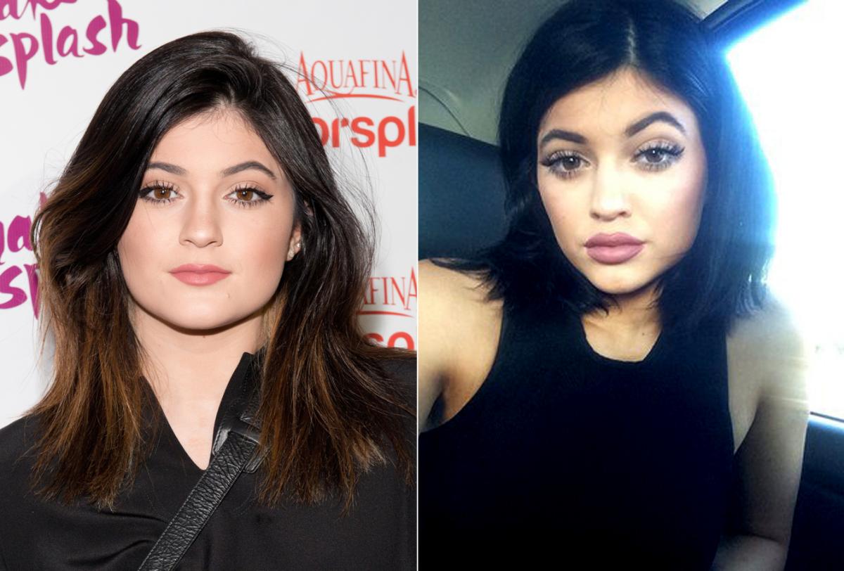 kylie jenner plastic surgery, кайли дженнер пластические операции