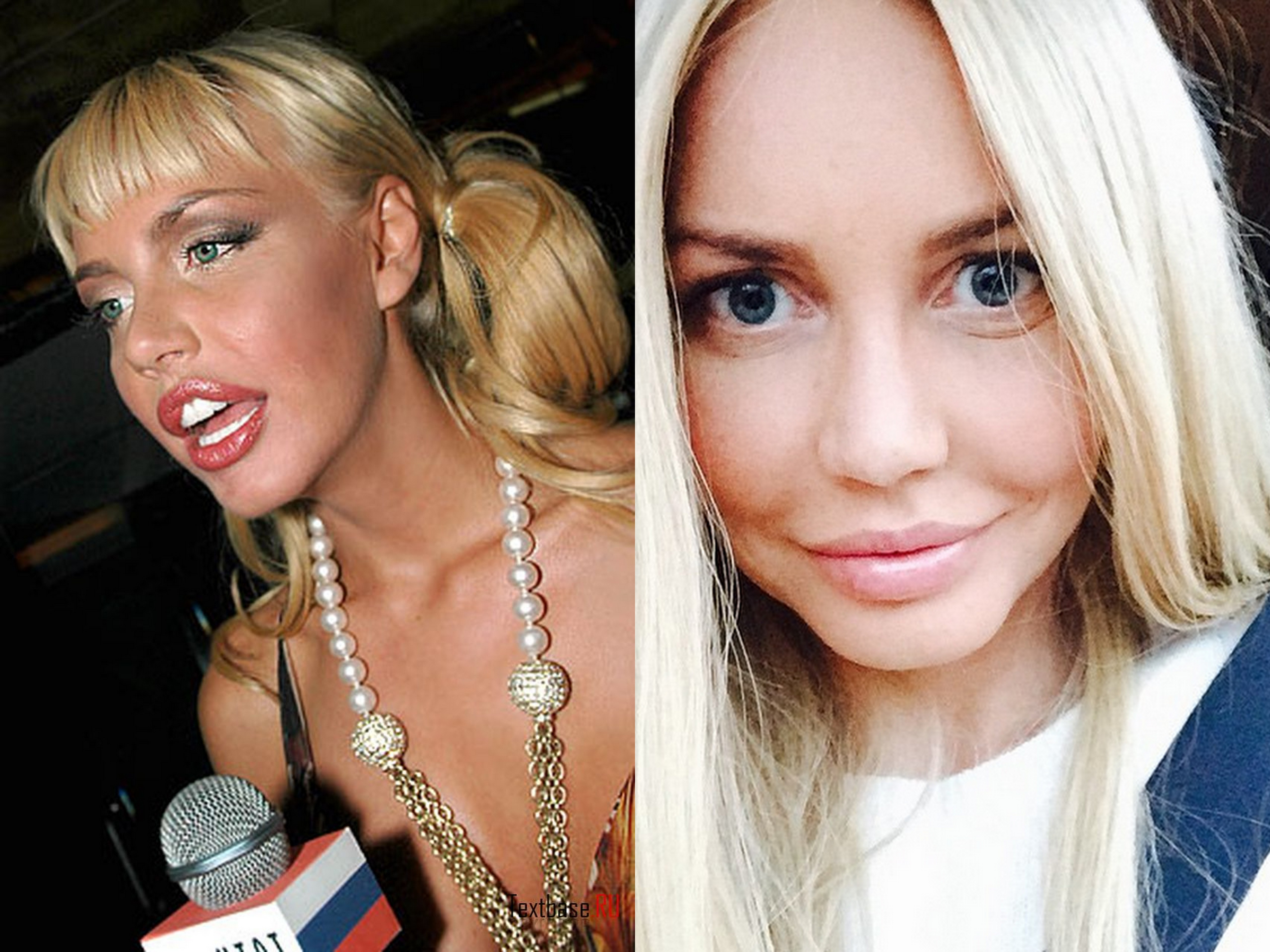 Маша малиновская фото до и после операции