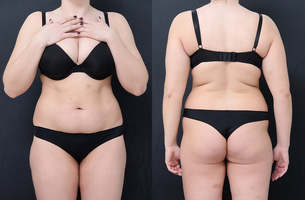 Битва с лишним весом