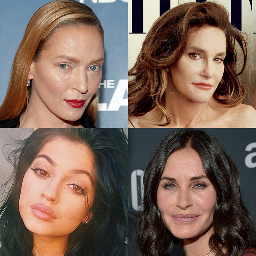 Звезды, которых мы не узнали из-за пластики в 2015 году