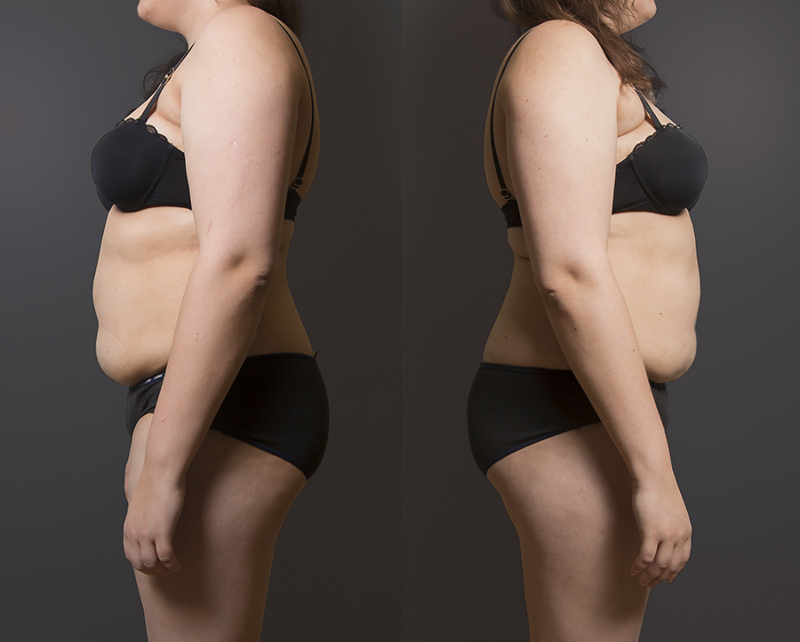 Эксперименты PEOPLETALK: битва с лишним весом. Неделя первая