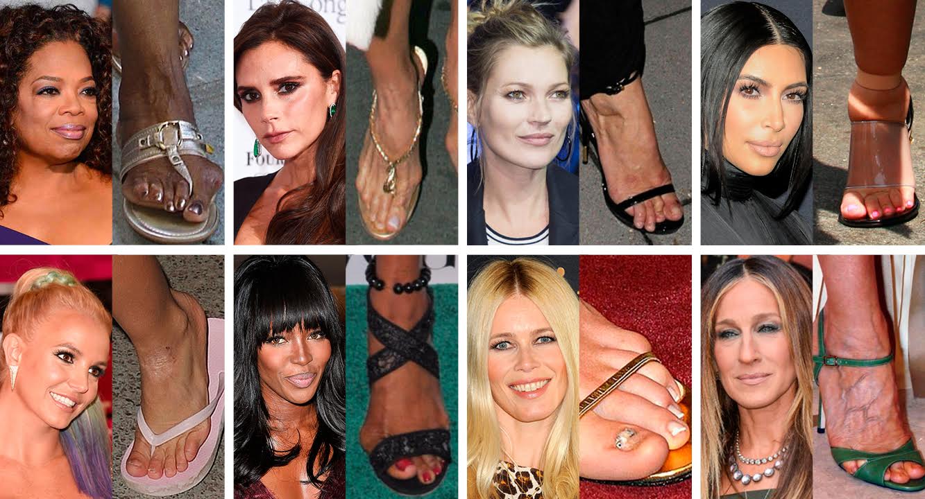 Самые непривлекательные стопы звезд