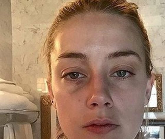 Избитая Эмбер Херд появилась на обложке журнала People