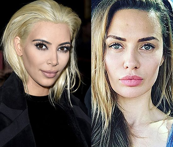 Виктория Боня делает уколы красоты у врача Ким Кардашьян