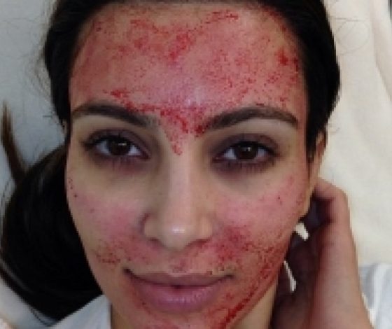 Самые неудачные селфи звезд