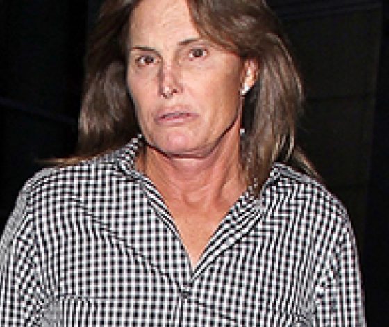 Отчим Ким Кардашьян сделал операцию по увеличению груди