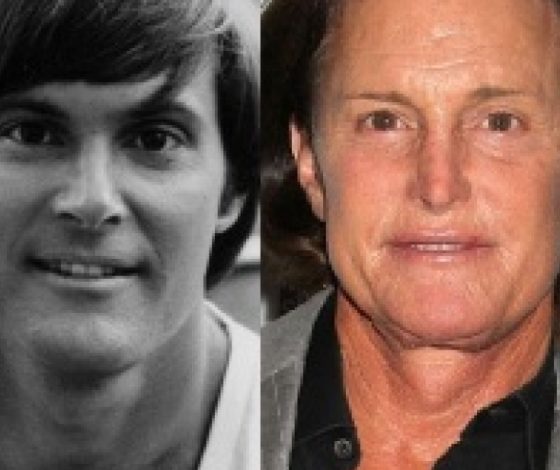 Как менялась внешность отчима Ким Кардашьян