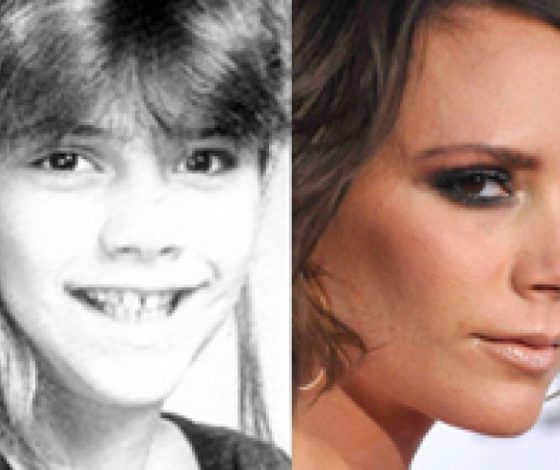 Топ-30 звезд, которые в детстве были «гадкими утятами»