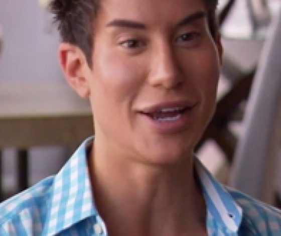 «Живой Кен» сделал новую пластическую операцию