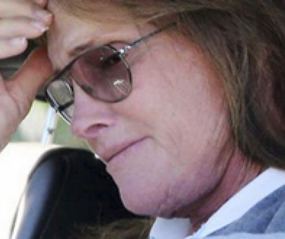 Сколько потратил Брюс Дженнер на смену пола