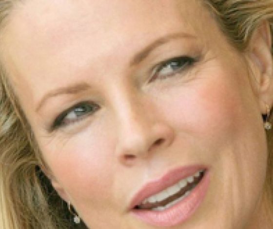 Ким Бейсингер не узнают после пластической операции