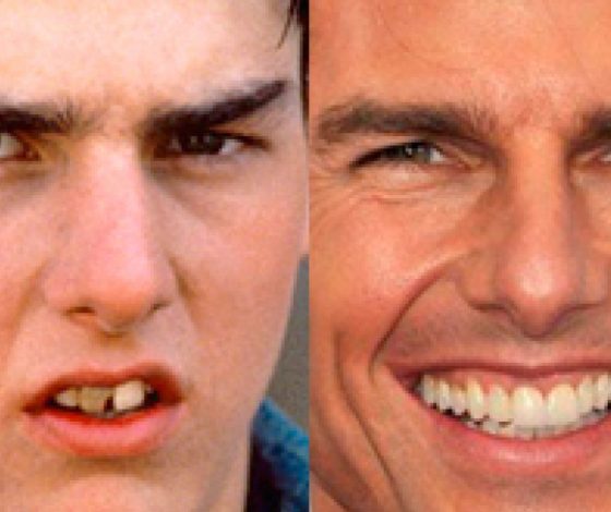 Звездные улыбки до похода к дантисту