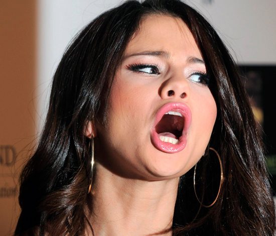 Самые неудачные фото Селены Гомес