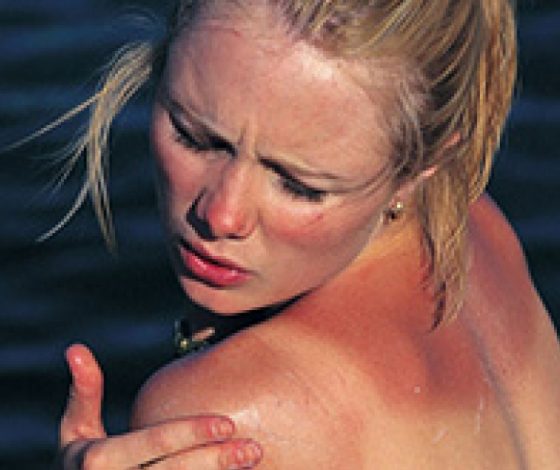 Звезды, которые сгорели на солнце