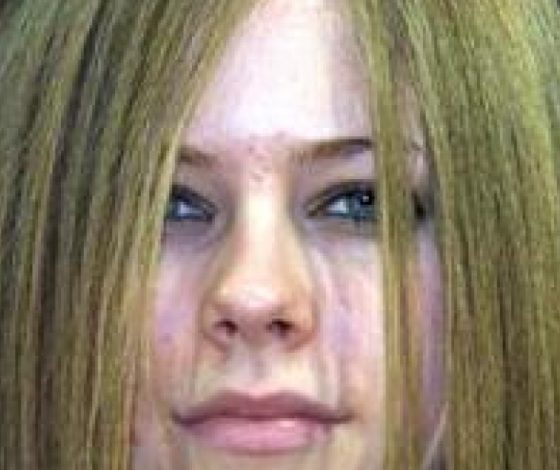 Прыщи атакуют! 10 звезд с проблемной кожей