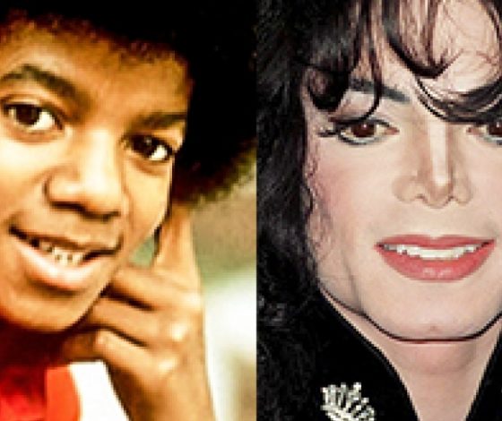 Эволюция внешности Майкла Джексона