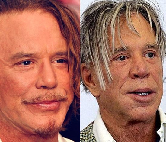 Звезды, которых пластика изменила до неузнаваемости