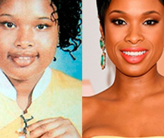 Звезды, которые страдали в детстве от лишнего веса