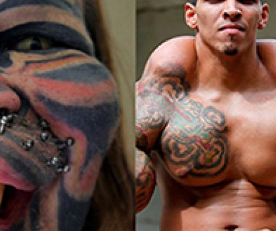 Шокирующие случаи пластических операций