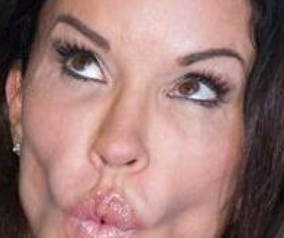 Звезды с дефектами внешности