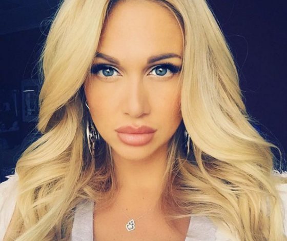 Русские красавицы до и после пластики