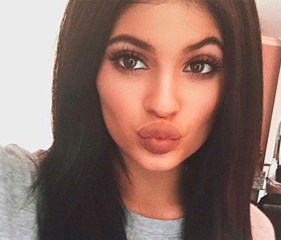 Кайли Дженнер рассказала всю правду про свои губы