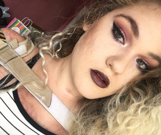 На них нужно подписаться: блогер с инвалидностью Кейтлин Доброу