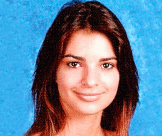 Звезды до и после пластики: Эмили Ратаковски