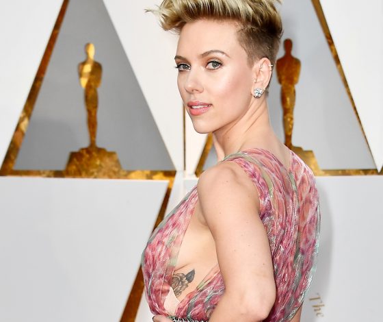 Звезды до и после пластики: Скарлетт Йоханссон