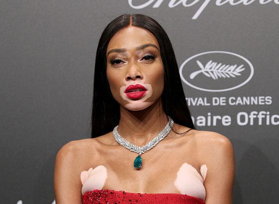 Не такие как все! 7 моделей с необычной внешностью