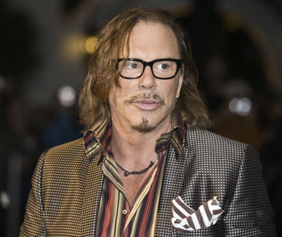 Топ-10 звезд, которые переборщили с пластикой