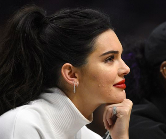 А так и не скажешь: у Кендалл Дженнер проблемы с кожей!