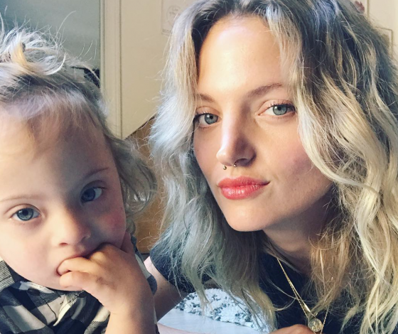 Первый ребенок с синдромом Дауна на обложке Vogue