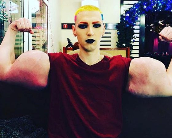 Не для слабонервных:  Кирилл «руки-базуки» сделал новую операцию