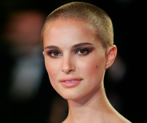 Звезды без волос: лысые и красивые