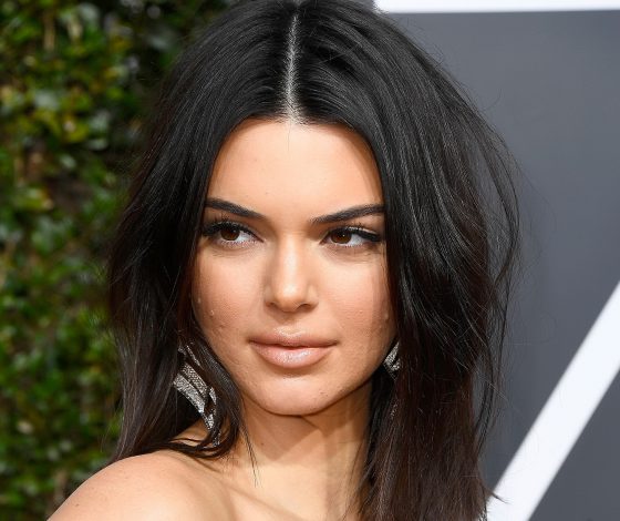 Что обсуждали все после «Золотого глобуса»? Прыщи Кендалл Дженнер!