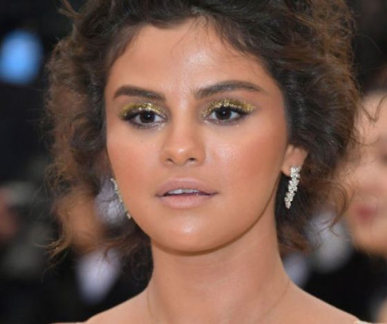 Селена Гомес, Ким Кардашьян и другие звезды, которые переборщили с автозагаром