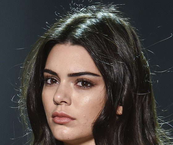 20 звезд, у которых проблемы с кожей