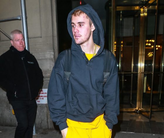 Что с ним? Джастин Бибер напугал фанатов своим видом