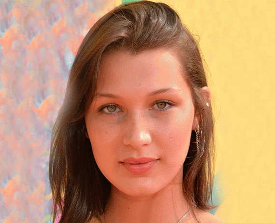 Тест: было или не было? Угадай, кто из звезд делал пластику