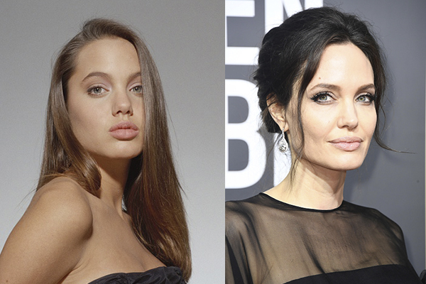 Как у звезды: сколько стоит сделать скулы Анджелины Джоли?