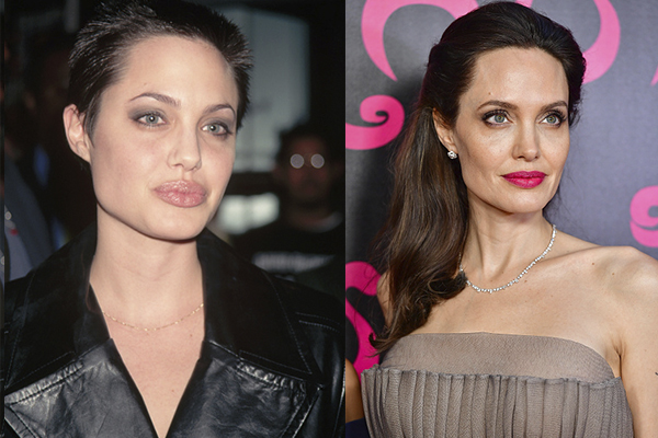 Как у звезды: сколько стоит сделать скулы Анджелины Джоли?