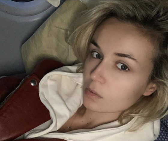 Они не стесняются! Собрали фото русских звёзд без макияжа