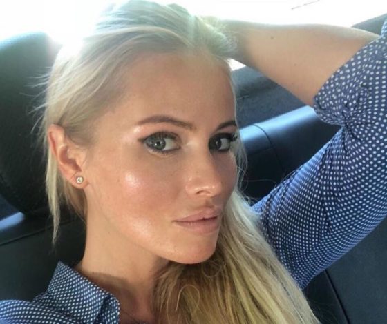 Дана Борисова сделала подтяжку лица