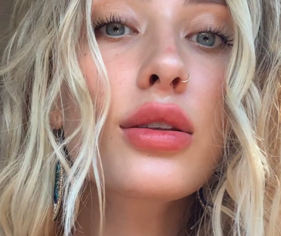 «К черту все, спасите коал»: австралийская модель заработала 700 тысяч долларов на борьбу с пожарами своими фото