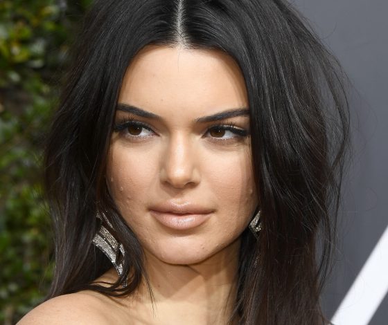 Звезды, у которых акне, и они не скрывают это