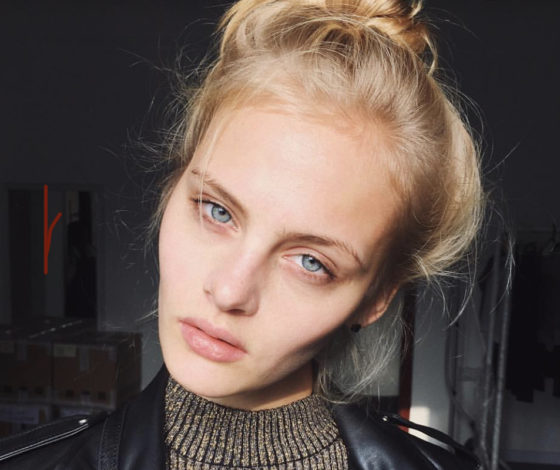 «Банальная неосторожность»: очнувшаяся после падения модель Пунтус о несчастном случае